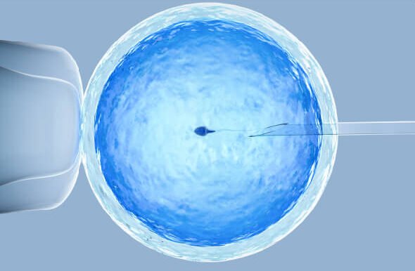 Assisted Reproductive Technologies